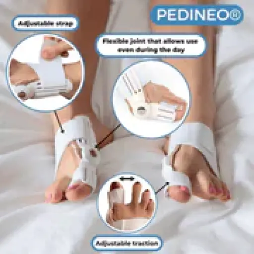 Pedineo